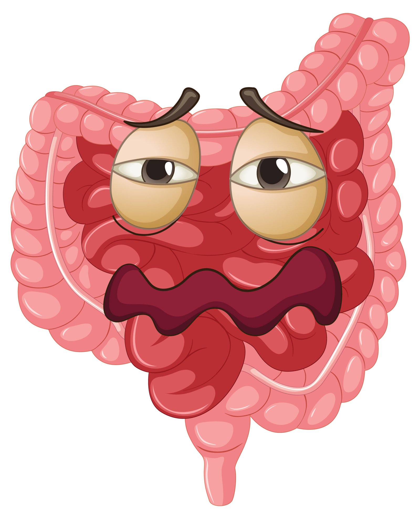Ilustración de intestino enfermo